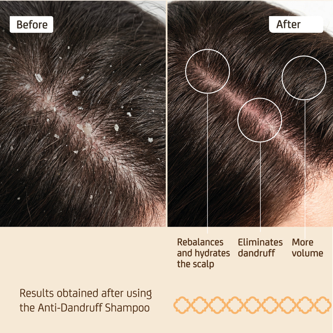 Anti-Dandruff Shampoo 250 ml