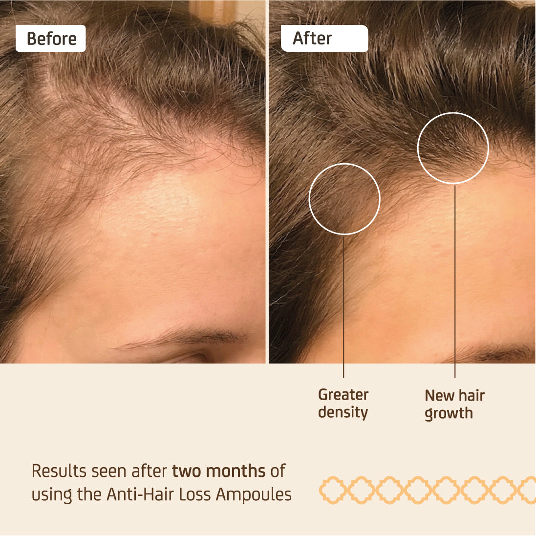 Effective Anti-Hair Loss Ampoule 1 x 10 ml