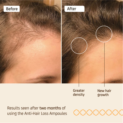 Effective Anti-Hair Loss Ampoule 1 x 10 ml