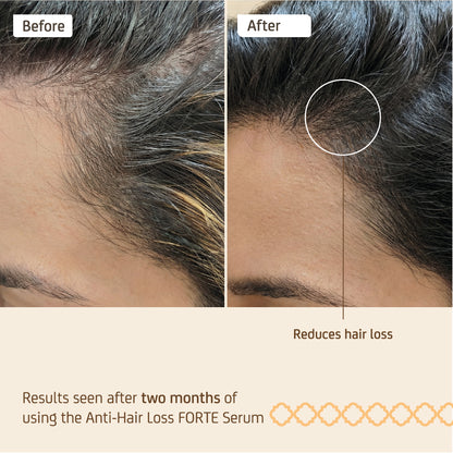 ANTI-HAIR LOSS FORTE SPRAY (70ML)