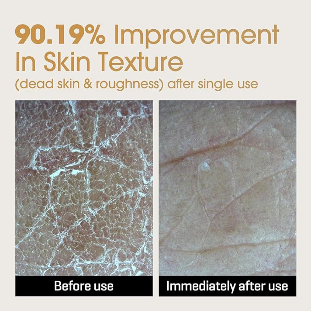 GALACTOMYCES GLUTATHIONE GLOW MILKY TONER [200ml]